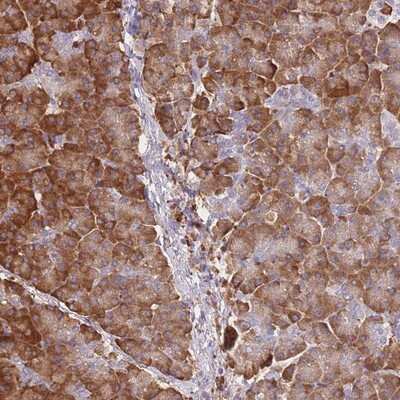 Immunohistochemistry-Paraffin: FRAT2 Antibody [NBP2-14026]