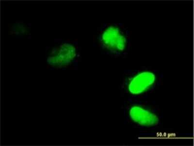 Immunocytochemistry/ Immunofluorescence: FRG1 Antibody (4A5) [H00002483-M01]