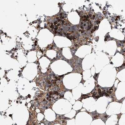 Immunohistochemistry-Paraffin: FRMD1 Antibody [NBP1-90832]