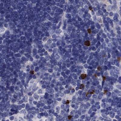 Immunohistochemistry-Paraffin: FRMD1 Antibody [NBP1-90832]