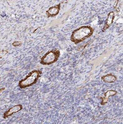 Immunohistochemistry-Paraffin: FRMD3 Antibody [NBP2-33879]