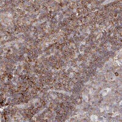 Immunohistochemistry-Paraffin: FRMD3 Antibody [NBP2-33879]