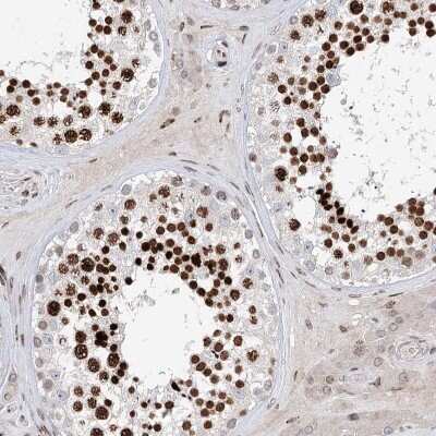 Immunohistochemistry-Paraffin: FRMD4A Antibody [NBP1-90807]