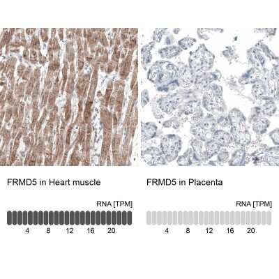 Immunohistochemistry-Paraffin: FRMD5 Antibody (CL9503) [NBP2-88935]