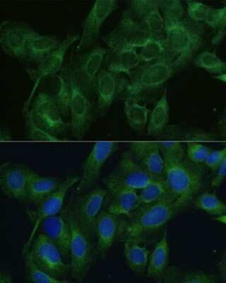 Immunocytochemistry/ Immunofluorescence: FRMD6 Antibody - Azide and BSA Free [NBP3-05019]