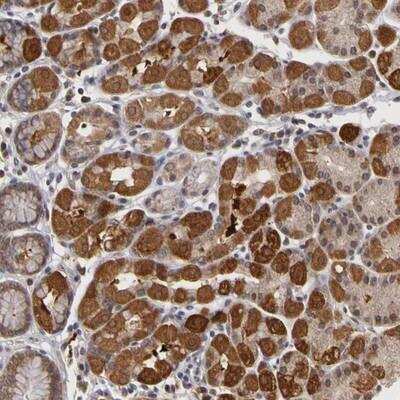 Immunohistochemistry-Paraffin: FRMD7 Antibody [NBP1-93762]