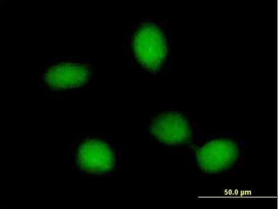 Immunocytochemistry/ Immunofluorescence: FRMD8 Antibody [H00083786-B01P]