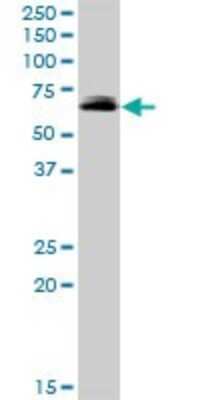 Western Blot: FRMD8 Antibody [H00083786-B01P]