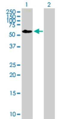 Western Blot: FRMD8 Antibody [H00083786-B01P]