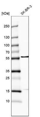 Western Blot: FRMD8 Antibody [NBP2-55142]