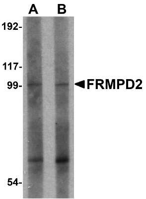 Western Blot: FRMPD2 AntibodyBSA Free [NBP1-77083]