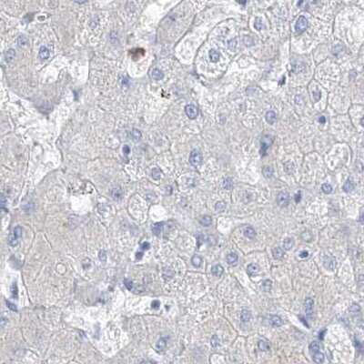 Immunohistochemistry-Paraffin: FRS3 Antibody [NBP1-83420]