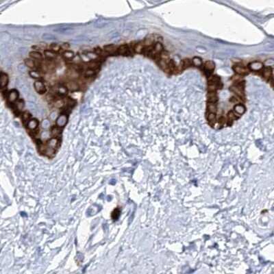 Immunohistochemistry-Paraffin: FRS3 Antibody [NBP1-83420]