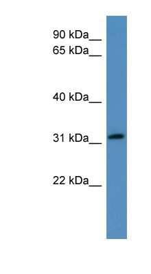 Western Blot: sFRP-3/FRZB Antibody [NBP1-79551]