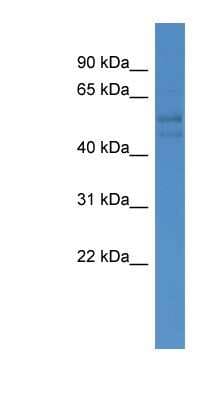 Western Blot: FSCN3 Antibody [NBP1-79541]