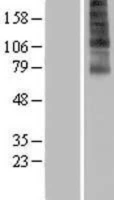 Western Blot: FSCN3 Overexpression Lysate [NBP2-06657]