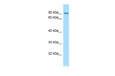 Western Blot: FSD2 Antibody [NBP3-09505]