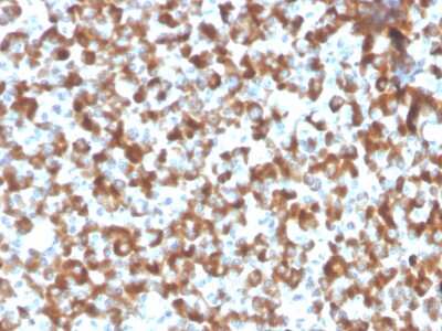 Immunohistochemistry-Paraffin: FSH beta Antibody (FSHb/2033R) - Azide and BSA Free [NBP3-08577]
