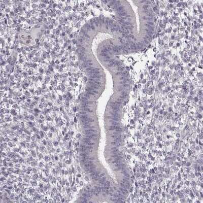 Immunohistochemistry-Paraffin: FSH beta Antibody [NBP2-57723]