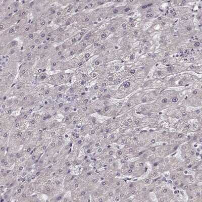 Immunohistochemistry-Paraffin: FSH beta Antibody [NBP2-57723]