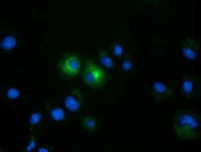 Immunocytochemistry/ Immunofluorescence: FSH beta Antibody (OTI2A6) - Azide and BSA Free [NBP2-70781]