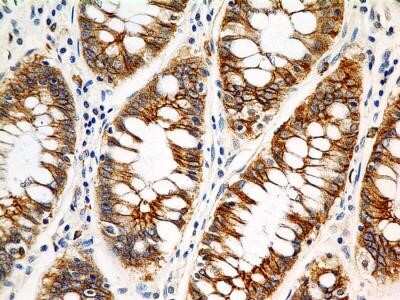 Immunohistochemistry: FSHR Antibody (6E8.2F5) - Azide and BSA Free [NBP2-80743]