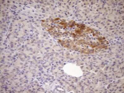 Immunohistochemistry: FSIP1 Antibody (OTI4F9) [NBP2-45738]