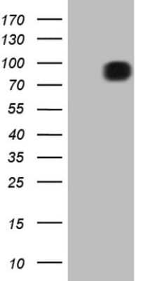 Western Blot: FSIP1 Antibody (OTI4F9) [NBP2-45738]