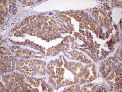 Immunohistochemistry: FSIP1 Antibody (OTI4F9) - Azide and BSA Free [NBP2-72451]