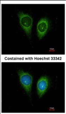 Immunocytochemistry/ Immunofluorescence: Follistatin-like 1/FSTL1 Antibody [NBP2-16539]