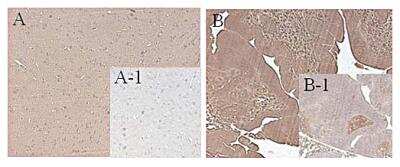 Immunohistochemistry-Paraffin: FTO Antibody (FT62-6) - Azide and BSA Free [NBP2-80050]