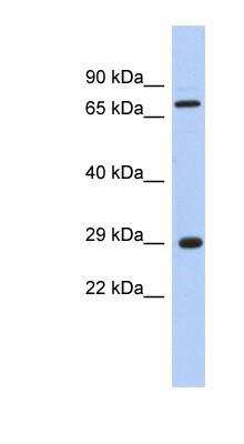 Western Blot: FTS Antibody [NBP1-53106]