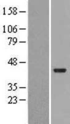 Western Blot: FTS Overexpression Lysate [NBL1-07445]