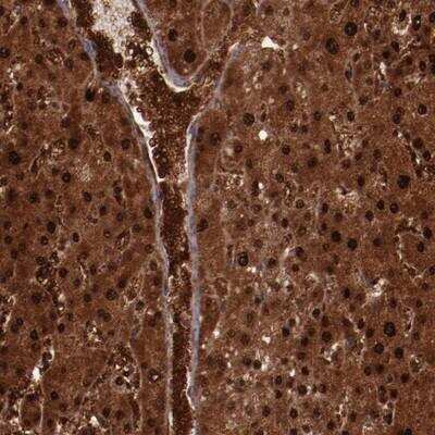 Immunohistochemistry-Paraffin: FTSJ1 Antibody [NBP1-85703]