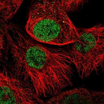 Immunocytochemistry/ Immunofluorescence: FTSJD2 Antibody [NBP1-83048]