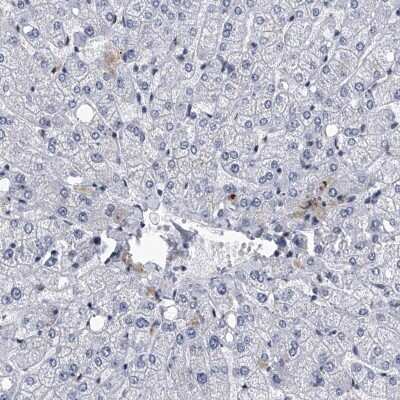 Immunohistochemistry-Paraffin: FTSJD2 Antibody [NBP1-83048]