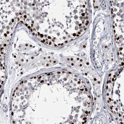 Immunohistochemistry-Paraffin: FTSJD2 Antibody [NBP1-83048]