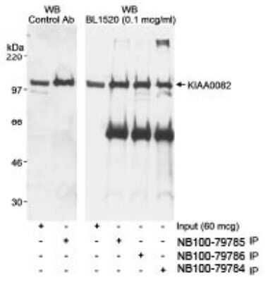 Immunoprecipitation: FTSJD2 Antibody [NB100-79786]