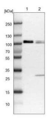 Western Blot: FTSJD2 Antibody [NBP1-83046]
