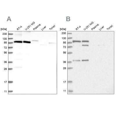 Western Blot: FTSJD2 Antibody [NBP1-83046]