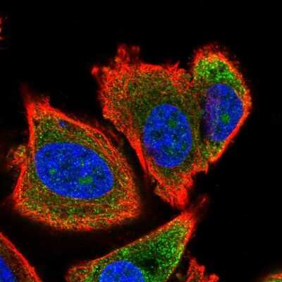 Immunocytochemistry/ Immunofluorescence: FUBI/MNSF beta/FAU Antibody [NBP2-32413]