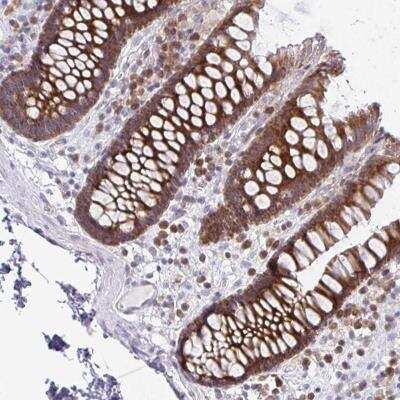 Immunohistochemistry-Paraffin: FUBI/MNSF beta/FAU Antibody [NBP2-32413]