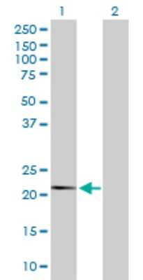 Western Blot: FUBI/MNSF beta/FAU Antibody [H00002197-D01P]