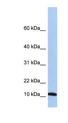 Western Blot: FUBI/MNSF beta/FAU Antibody [NBP1-55090]