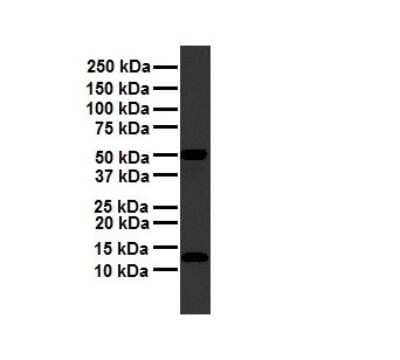 Western Blot: FUBI/MNSF beta/FAU Antibody [NBP1-55090]