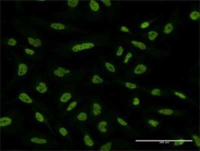 Immunocytochemistry/ Immunofluorescence: FUBP1 Antibody (2H3) [H00008880-M02]