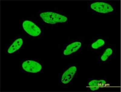 Immunocytochemistry/ Immunofluorescence: FUBP1 Antibody (3H4) [H00008880-M01]