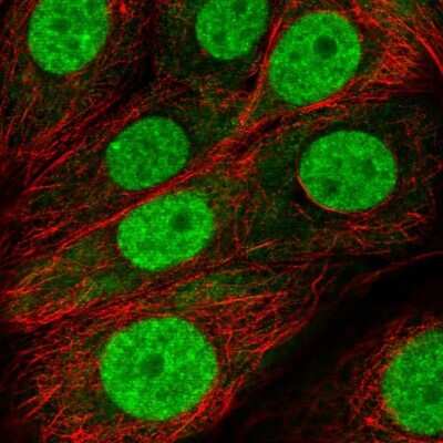 Immunocytochemistry/ Immunofluorescence: FUBP3 Antibody [NBP2-58466]