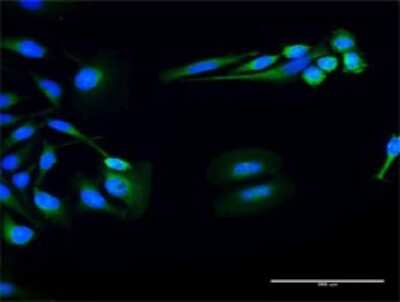 Immunocytochemistry/ Immunofluorescence: FUK Antibody [H00197258-D01P]
