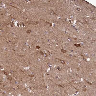 Immunohistochemistry-Paraffin: FUNDC1 Antibody [NBP1-81063]